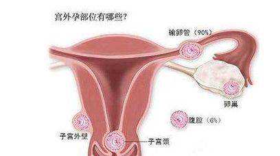 <b>浙江省人民医院做试管好吗，南京第一人民医院有精子库吗</b>